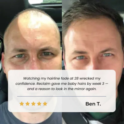 NaturaGrow™ – Hair Awakening Roll-On