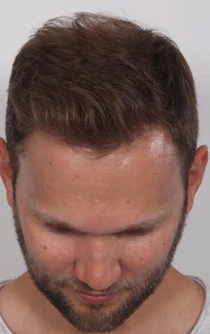 NaturaGrow™ – Hair Awakening Roll-On